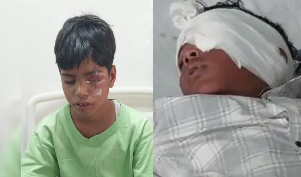 जयपुर में दिवाली की खुशी बनी दर्द की रात — पटाखों ने छीनी मासूमों की मुस्कान, SMS में 24 लोग भर्ती
