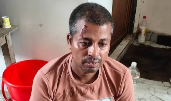Baruipur Minor Murder Case: Main Accused Dies During Police Crime Scene Reconstruction
